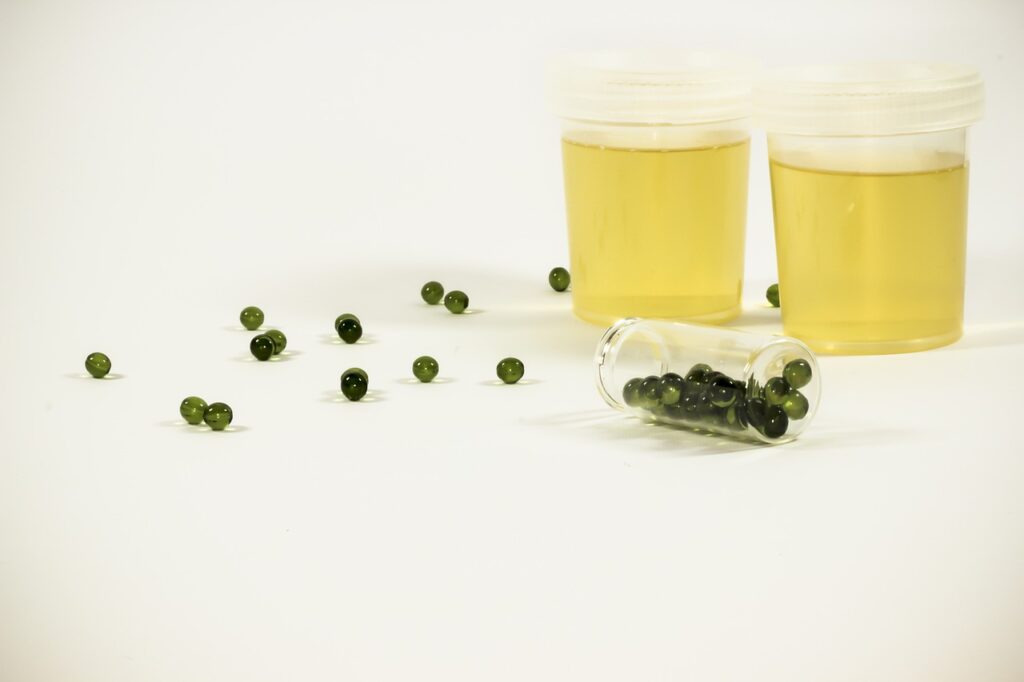 Close-up of a medical urine test tube for diagnostics, used by a doctor to analyze causes of excessive discharge of urine and inflammation.