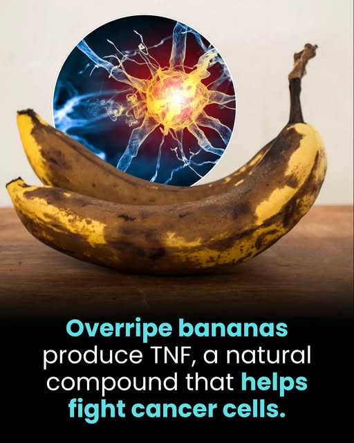 Overripe bananas aren’t just sweeter — they’re scientifically shown to produce higher levels of TNF, a natural compound that supports the immune system’s ability to fight abnormal cells. Including both apples and bananas in your diet offers an easy, natural way to boost wellness from the inside out. Overripe bananas with brown spots on a wooden table, illustrating their increased TNF (tumor necrosis factor) content — a natural compound that enhances immune defense and supports overall wellness. The image highlights the hidden health benefits of apples and bananas as functional foods.