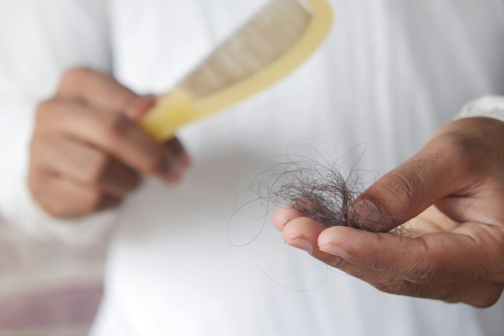 pexels-photo-9755382-9755382 A man holding a comb with several strands of hair caught in it, symbolizing hair loss and the struggle to prevent baldness.