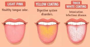 Tongue coating changes can reveal digestive imbalances that affect eggs digestibility and overall gut health. Illustration showing tongue coatings indicating digestive health—from healthy pink to yellow and white layers—used to explain how digestion and eggs digestibility reflect internal balance.