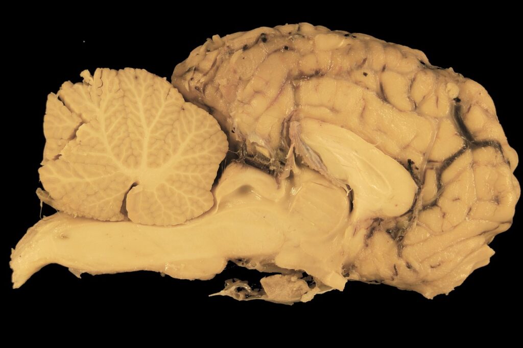 This detailed view of the brain highlights the command center of your entire nervous system. By using targeted techniques, you can directly influence these structures to calm your nervous system and shift from a state of stress to one of balance. Anatomical cross-section of a human brain, detailing the cerebrum, cerebellum, and brain stem—the primary structures involved when you work to calm your nervous system.